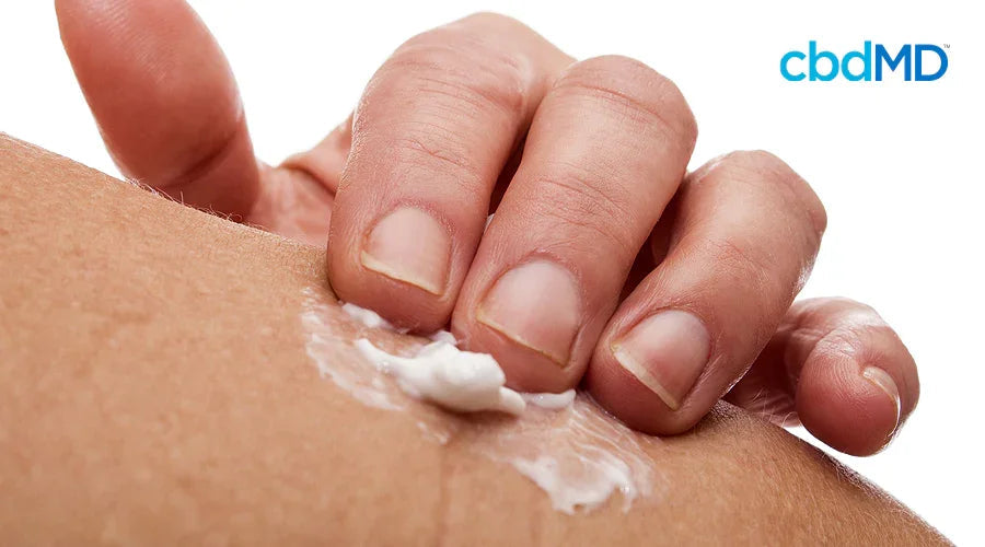Hand applying white cream to skin, cbd topical pain relief close-up, cbdMD logo visible