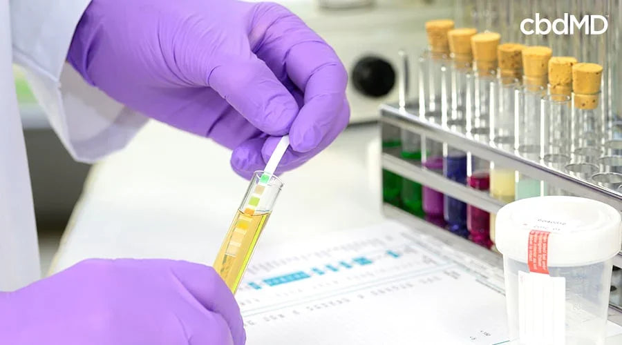 Lab technician with purple gloves testing urine sample using a drug test strip in laboratory.